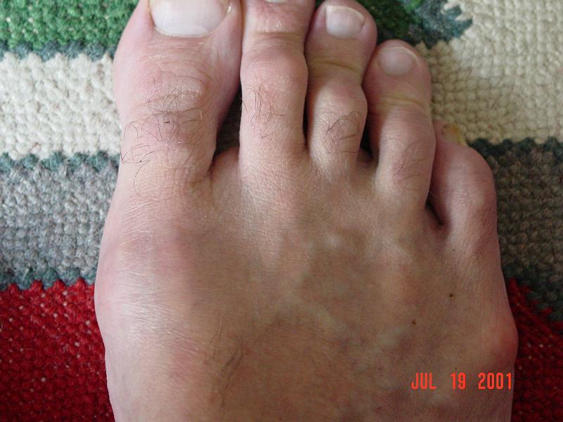 rwf foot.jpg